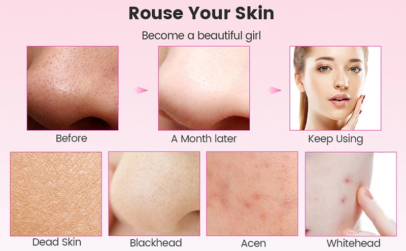 Ultrasound skin cleaner PRO