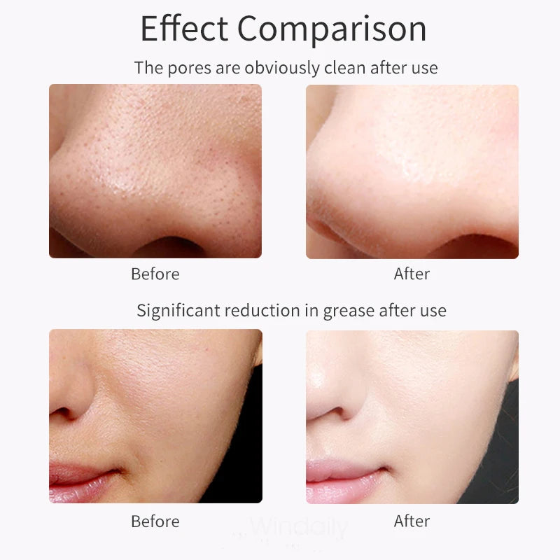 Ultrasound skin cleaner PRO
